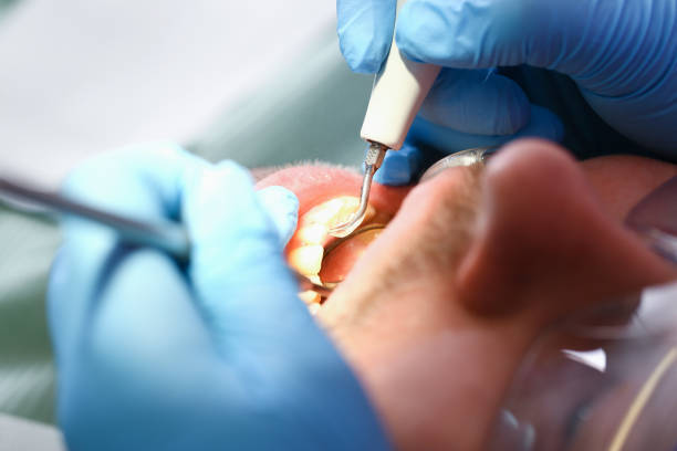 Best Urgent Care for Lost Fillings or Crowns in Centreville, MI