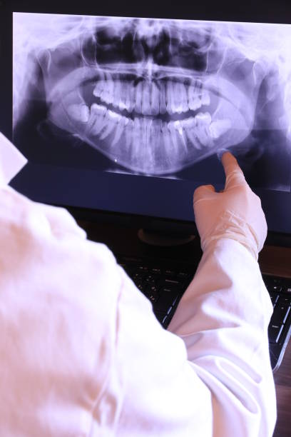 Best Emergency Root Canal Treatment in Centreville, MI