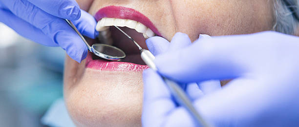 Best Emergency Treatment for Dental Infections or Abscesses in Centreville, MI